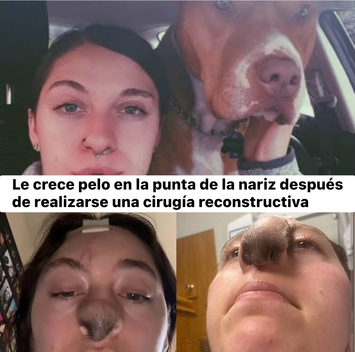 Dr. - En 2022 Trinity Rowles fue atacada por Irish, el perro pit-bull ...
