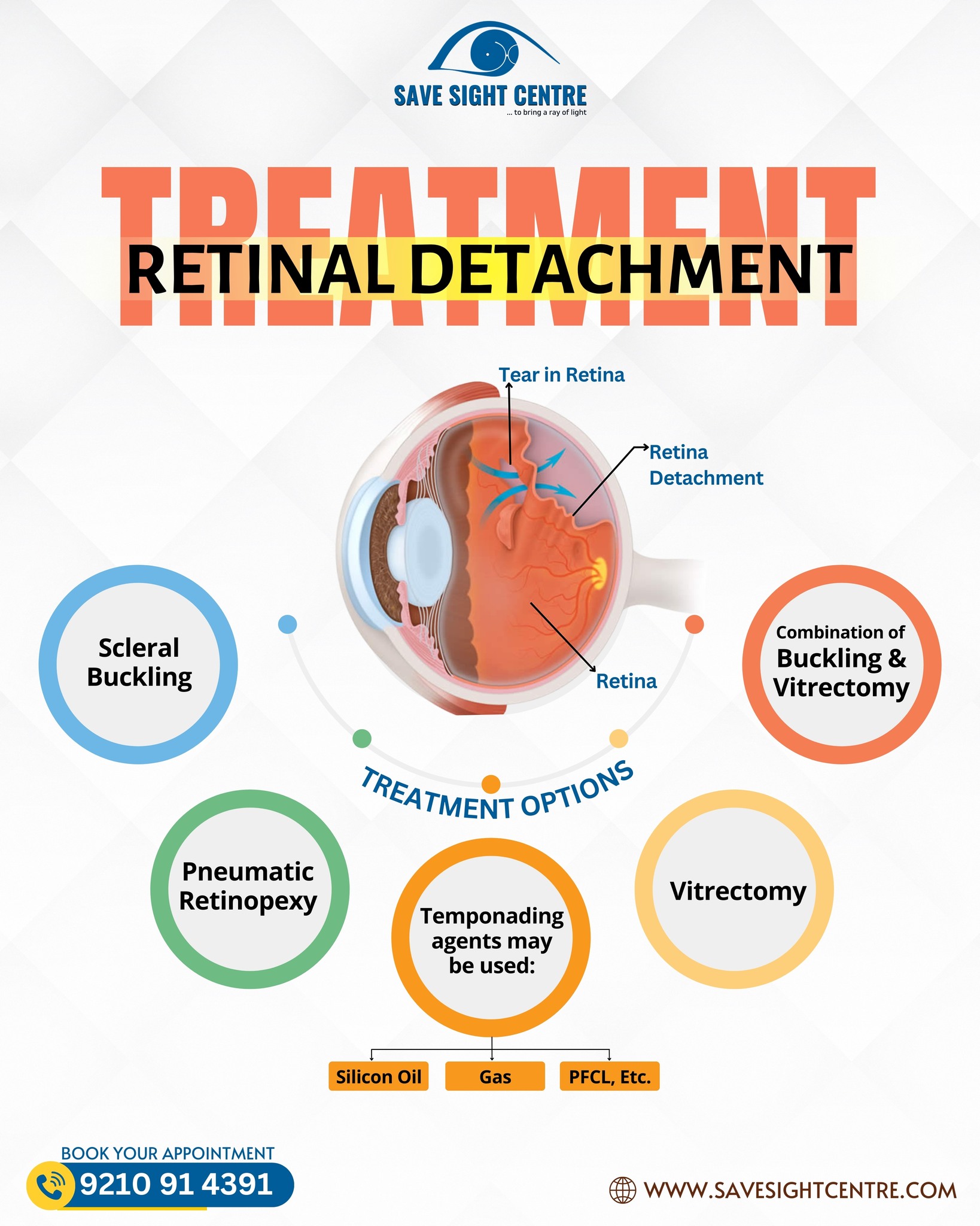 Save - Dealing with Retinal Detachment? Early treatment can protect ...