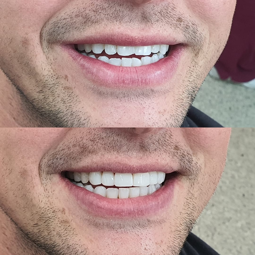 Parson Cross Dental | Sheffield
