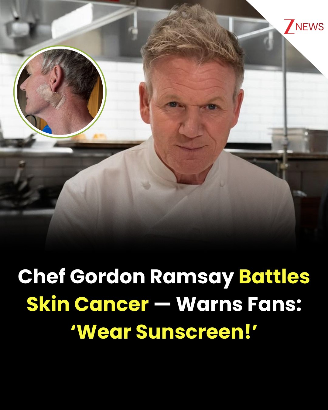 Zee - Gordon Ramsay Reveals Skin Cancer Diagnosis, Urges Fans To Use ...