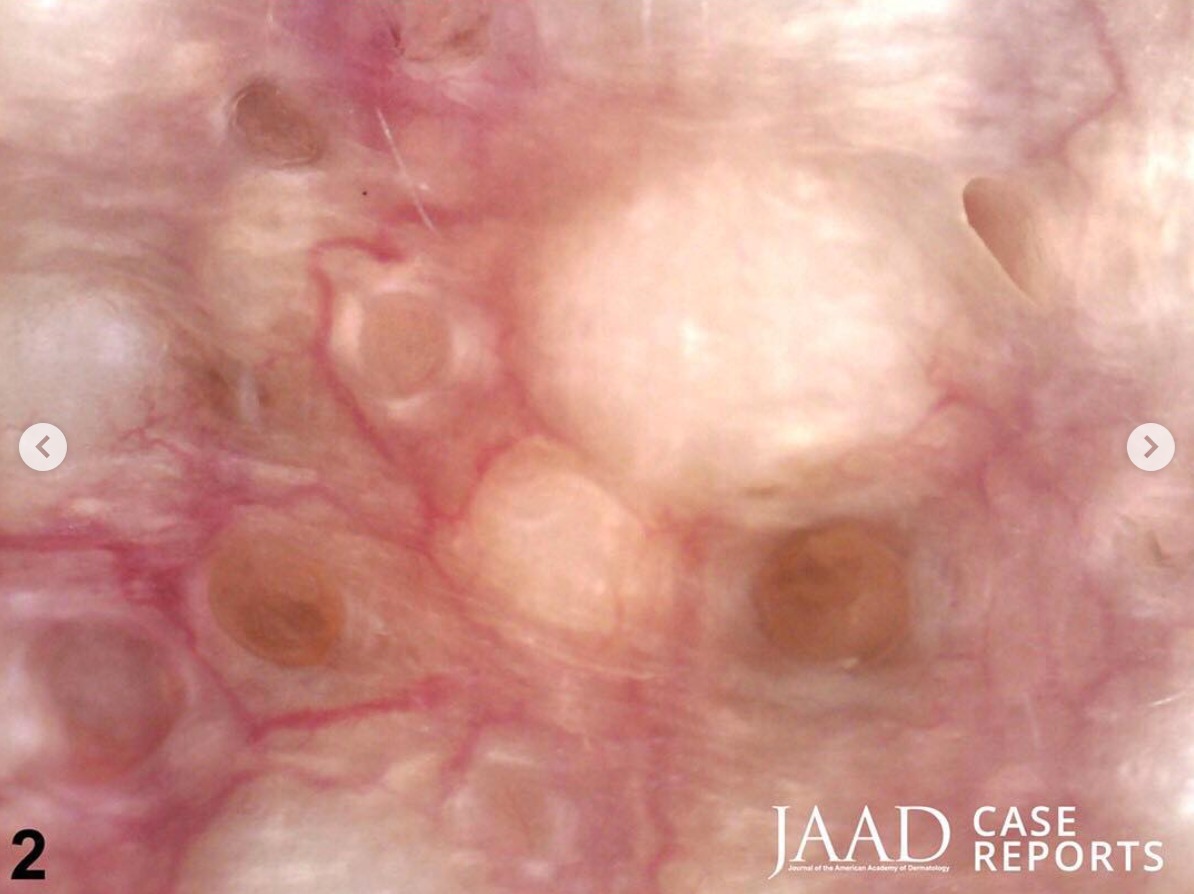 The stratum corneum (cornified... - Dermatology News Daily | Facebook