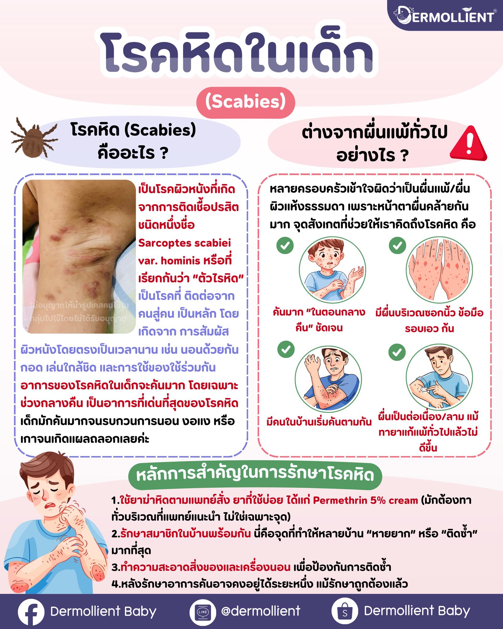 Dermollient - #โรคหิดในเด็ก (Scabies) รู้ทันก่อนคันทั้งบ้าน! #โรคหิด ...