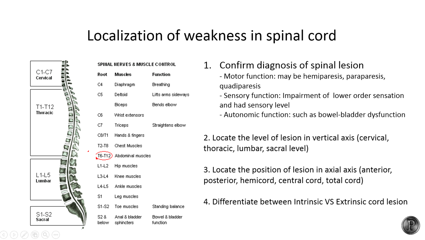 Neurologist P - [Medical student] Approach to weakness... | Facebook