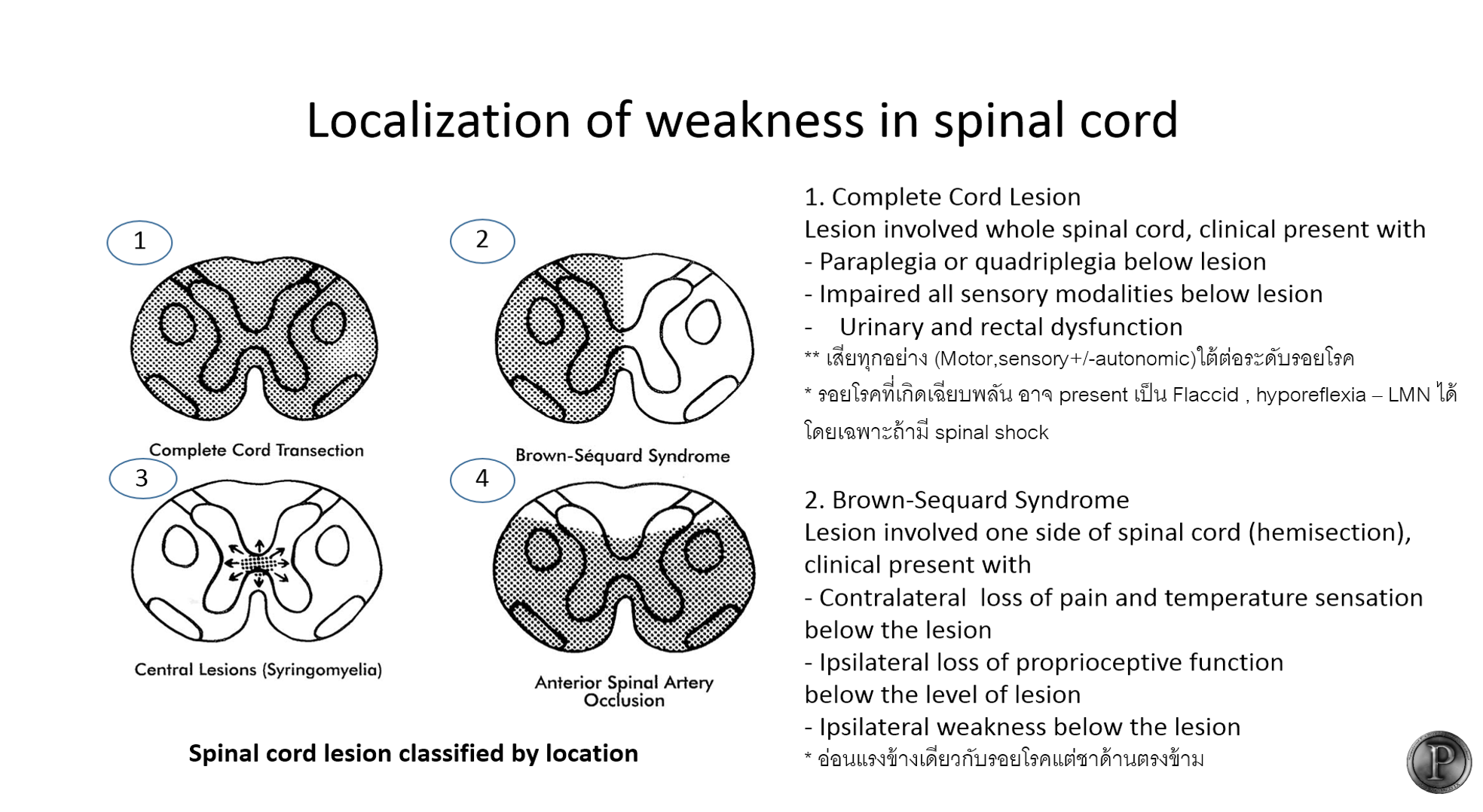 Neurologist P - [Medical student] Approach to weakness... | Facebook