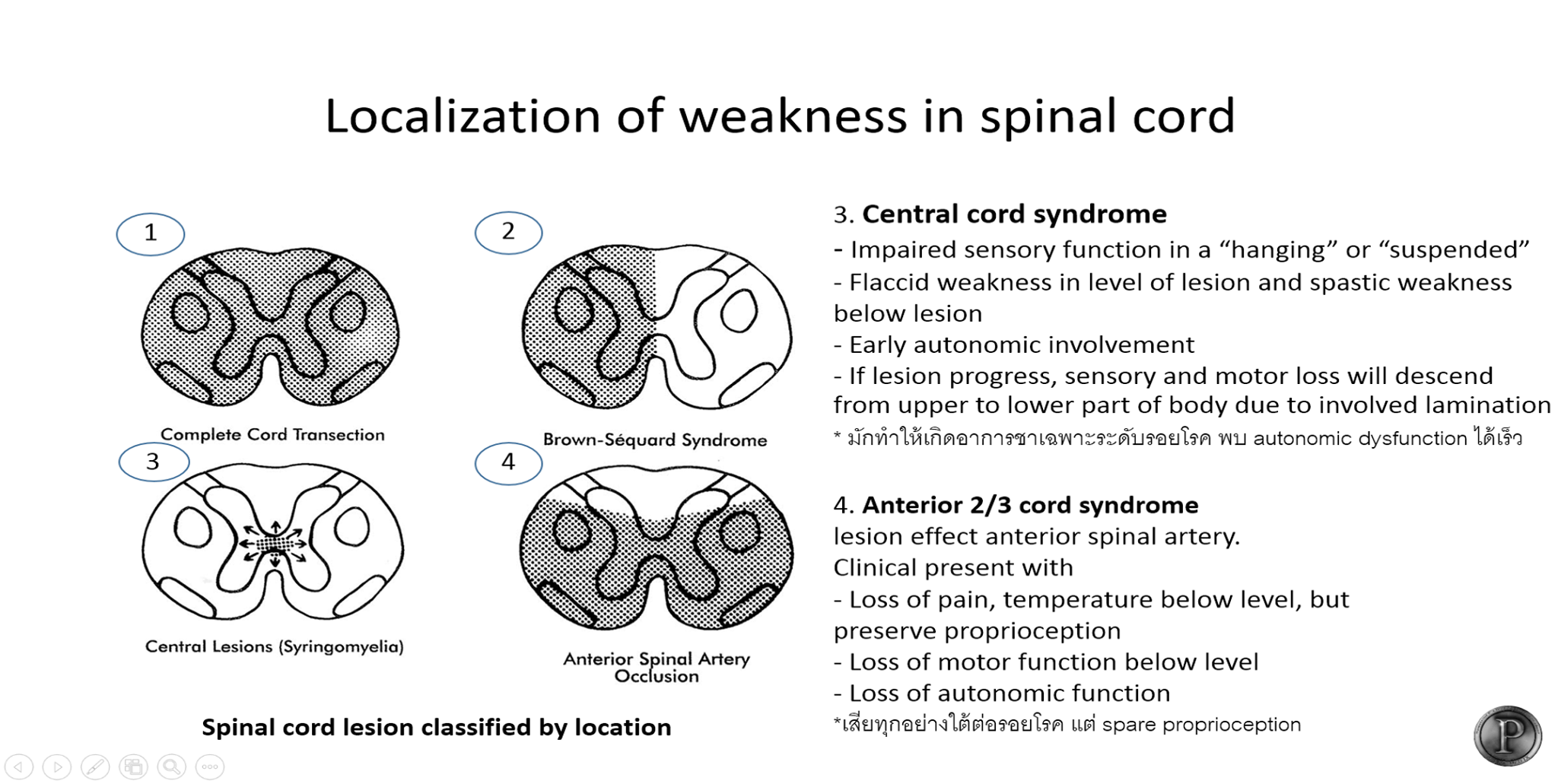 Neurologist P - [Medical student] Approach to weakness... | Facebook
