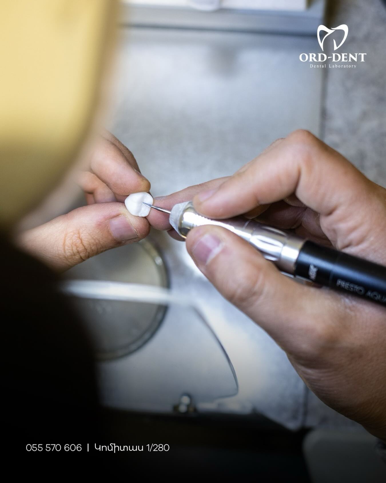 Ord-Dent Dental Laboratory | Yerevan