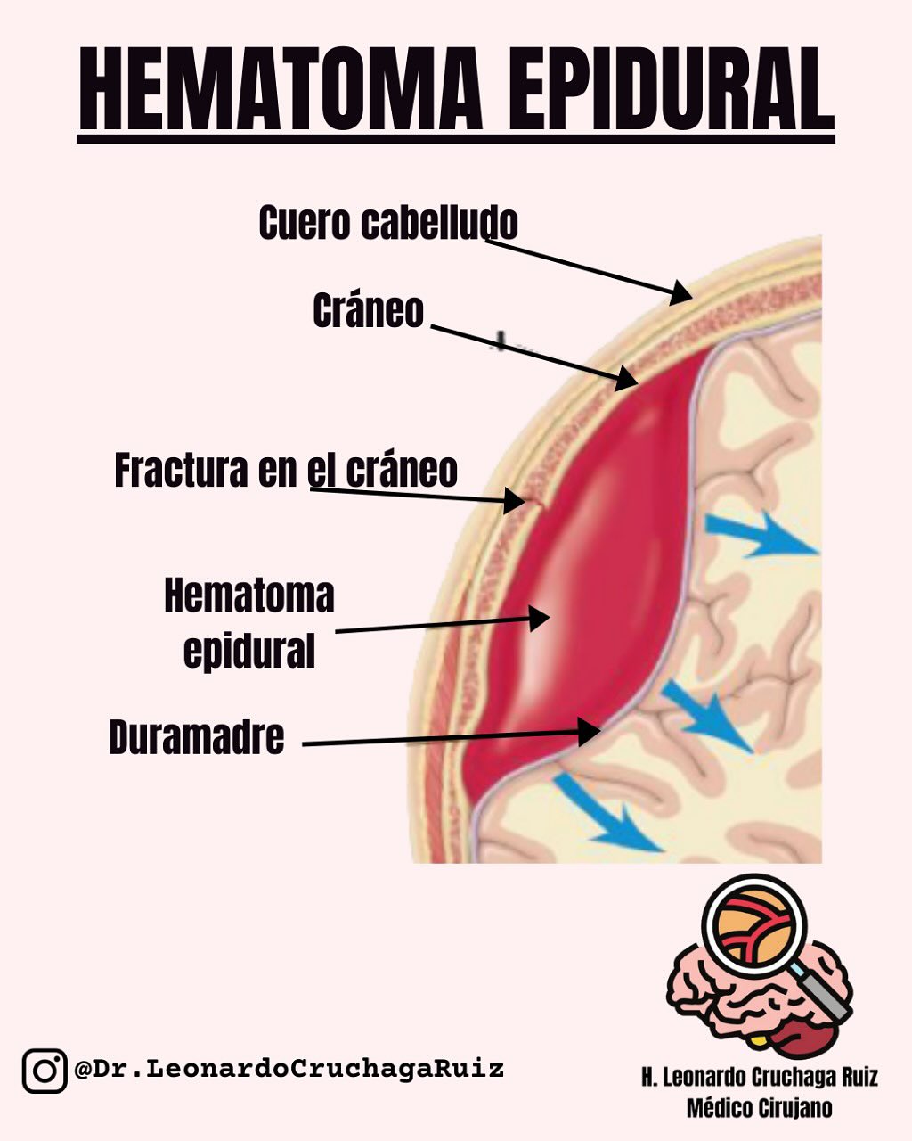 Dr. - ¡Hola chicos! Les dejo un cuadrito para que lo guarden y tengan ...