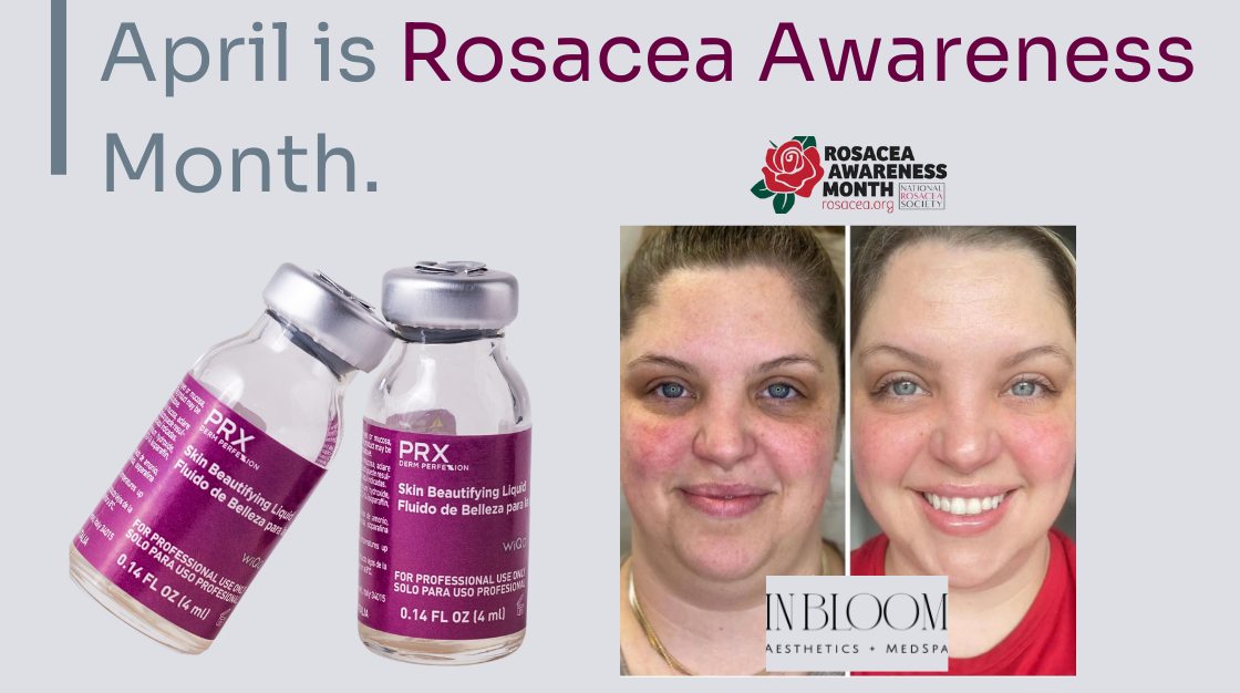 bpc 157 rosacea Functional Medicine for Rosacea: Root Cause Treatment  Revolution Health & Wellness Dr. Junith Thompsons Office |