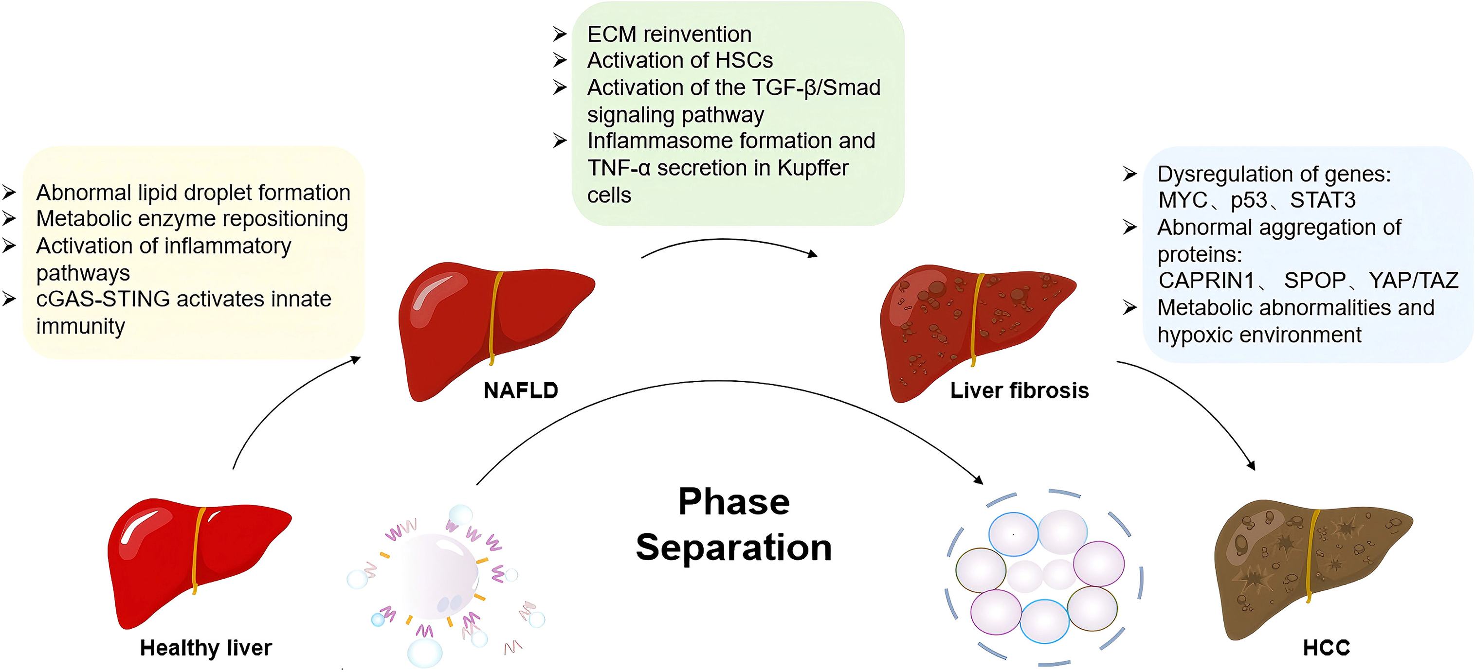 l carnitine liver cirrhosis L-Carnitine For Fatty [NAFLD] - Does It Help? LLPS in the Progression of