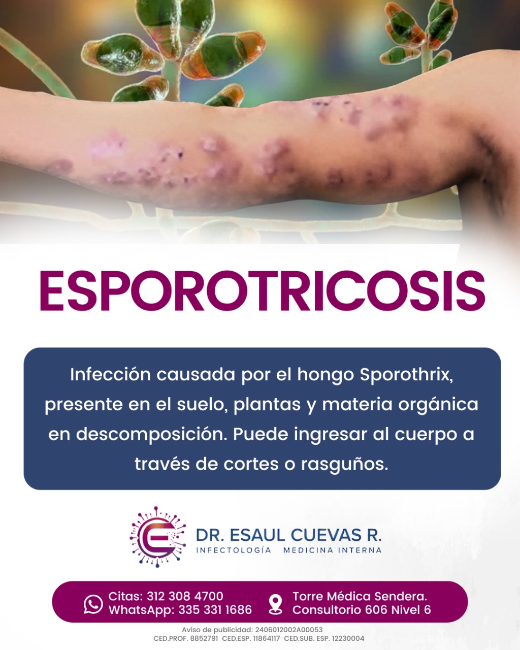 cuidado-con-la-esporotricosis-la-esporotricosis-es-una-infecci-n