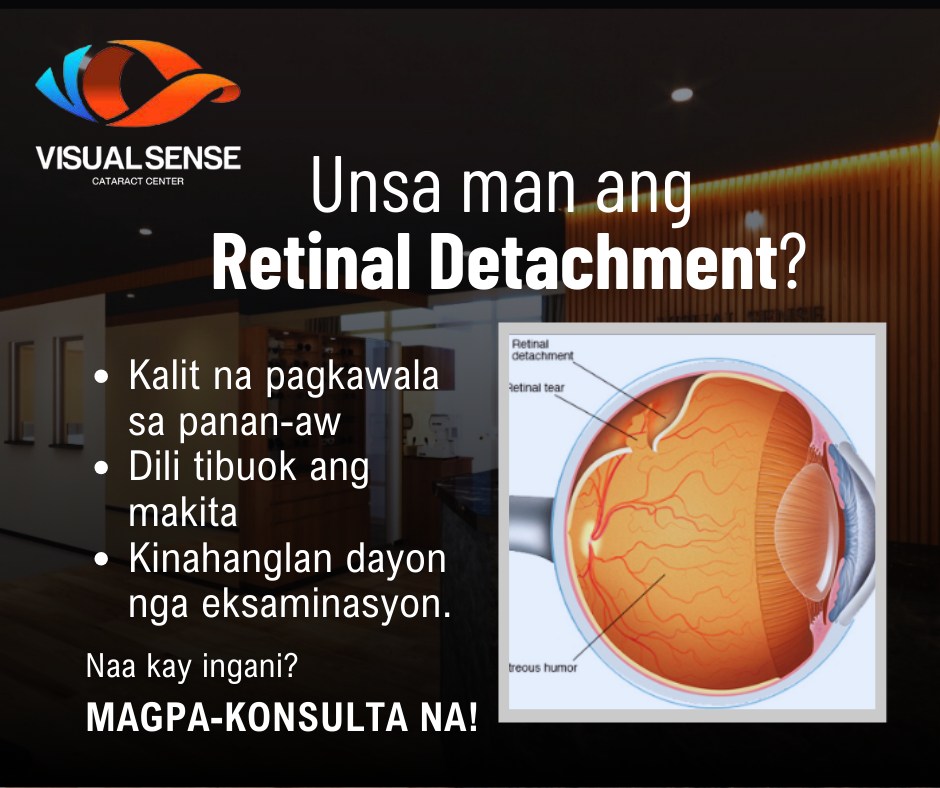Visual - 🛑 SEEING FLOATERS OR FLASHES OF LIGHT? IT COULD BE RETINAL ...