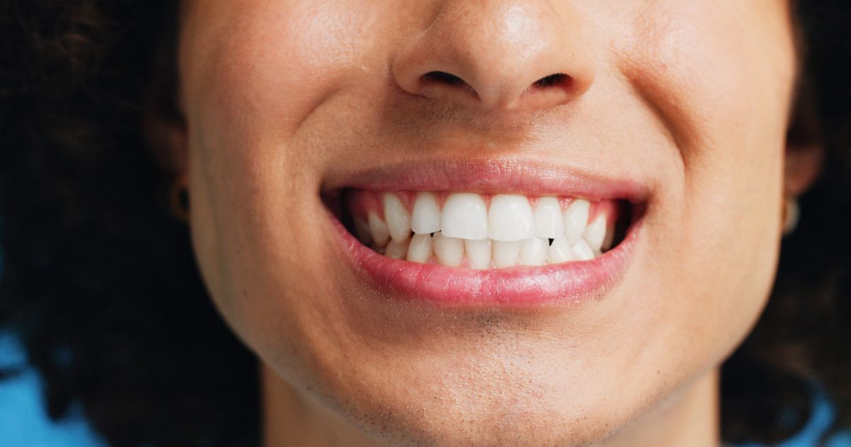 Dentists Are Begging You To Avoid This One Teeth Whitening Hack — Read more in the comments
