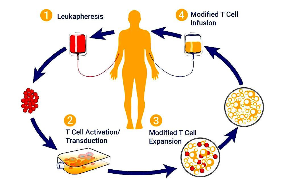 Untold - *MEDICAL BREAKTHROUGH* Israeli doctors use patients' own cells ...