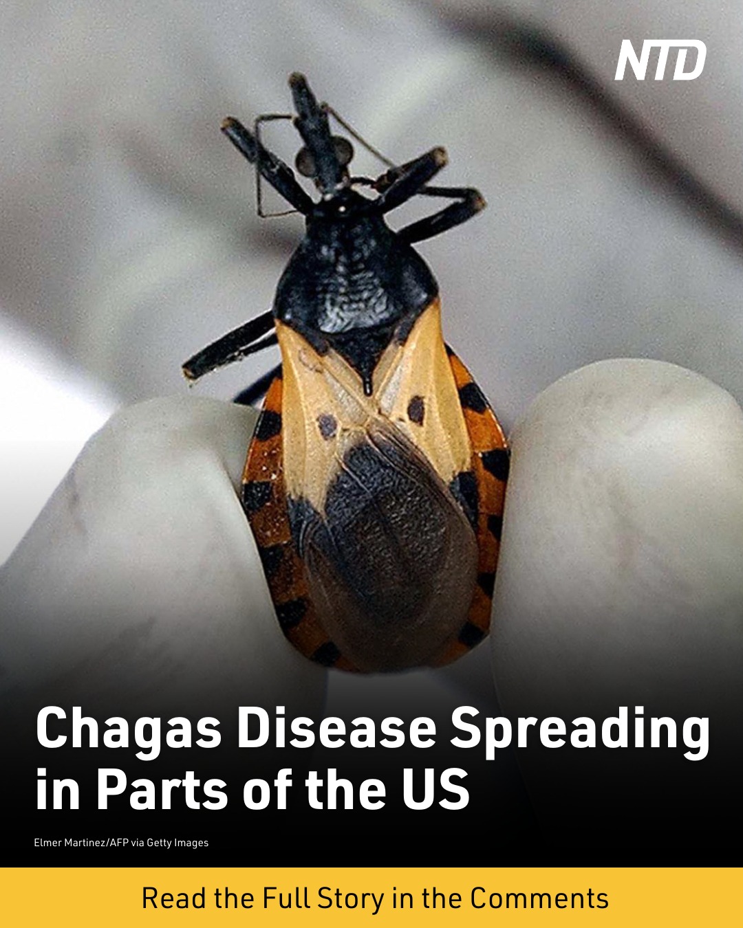 NTD - Spread by the 'kissing bug,' the disease can cause heart failure ...