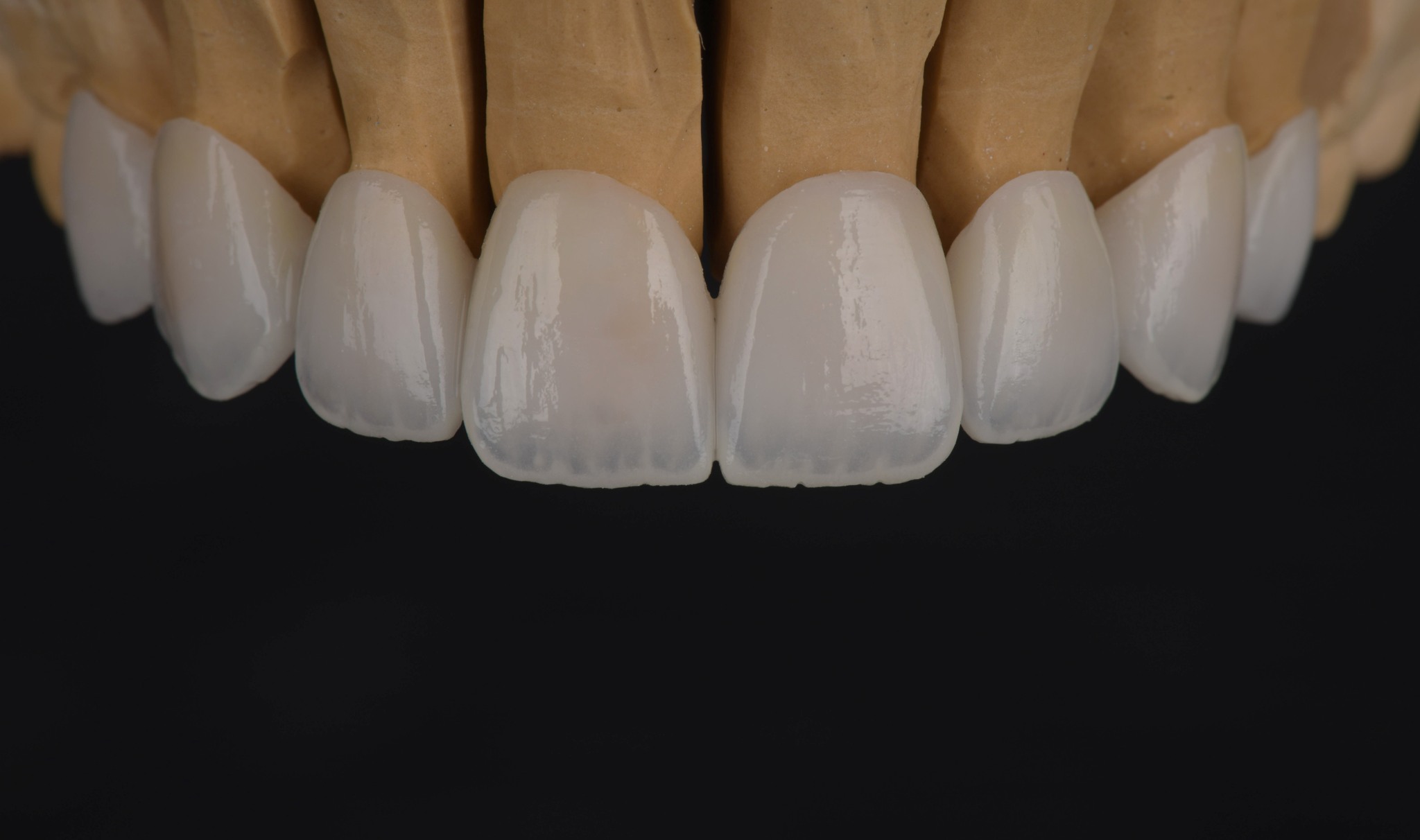 value dental lab | Bucharest