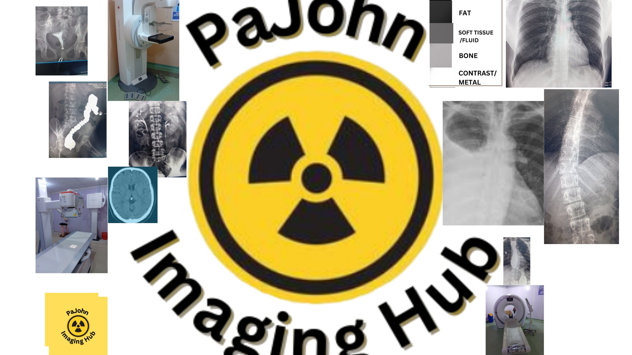 SIGNS IN RADIOLOGY: SILHOUTTEE SIGN #ImagingExperts #Radiographer # ...