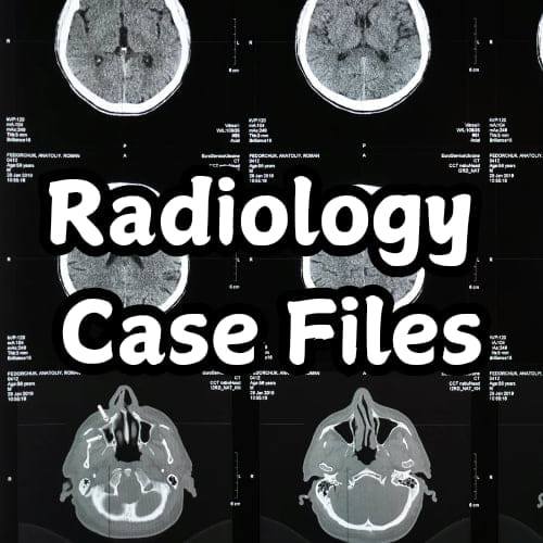 Radiography Student | 🟡 Lightbulb Sign | Facebook