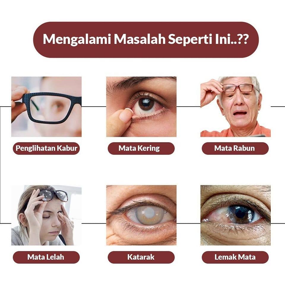 DEEP LEARNING DAN BERDIFERENSIASI Modul KURMER Bonus Laporan PMM Wali ...