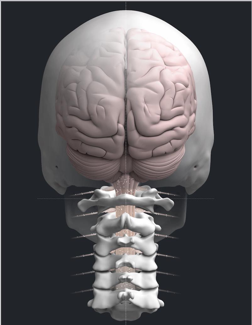 Johnson - When your atlas (top bone in your neck) misaligns, this ...