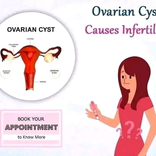 Non-cancerous cysts are fluid-filled sacs that can develop in various parts of the body and are usually harmless. However, some may cause discomfort, pain, or swelling depending on their size and location