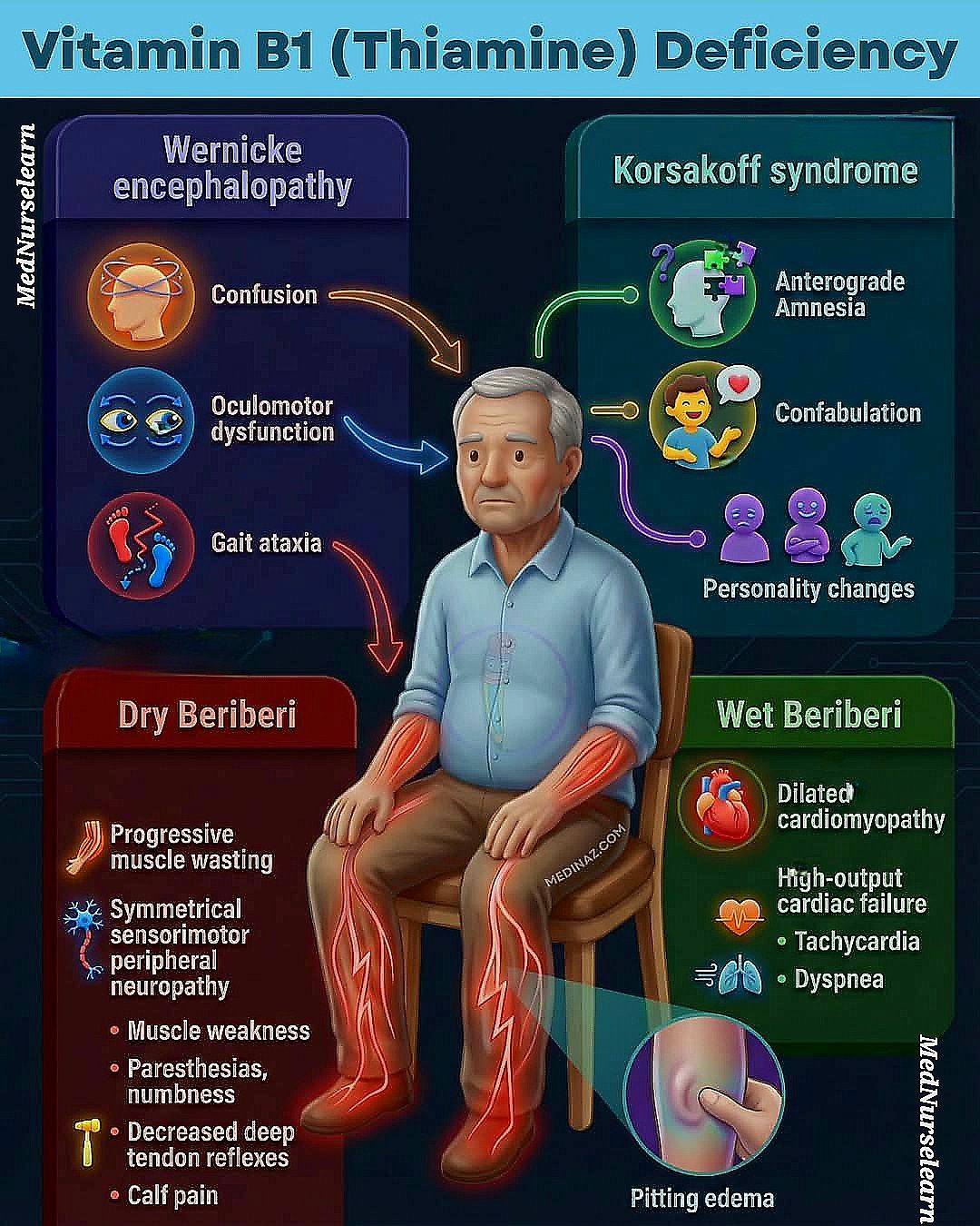 Thiamine deficiency features ✓