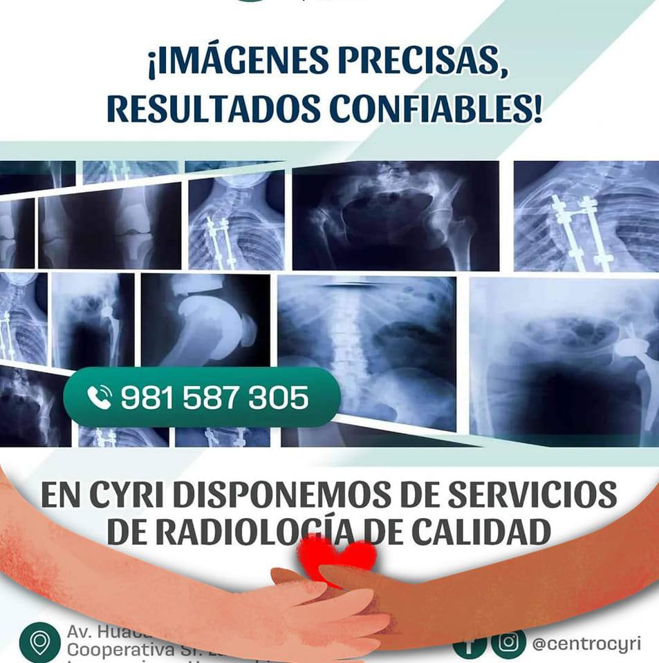 La Histerosalpingografía es... - Centro de Diagnóstico CYRI | Facebook