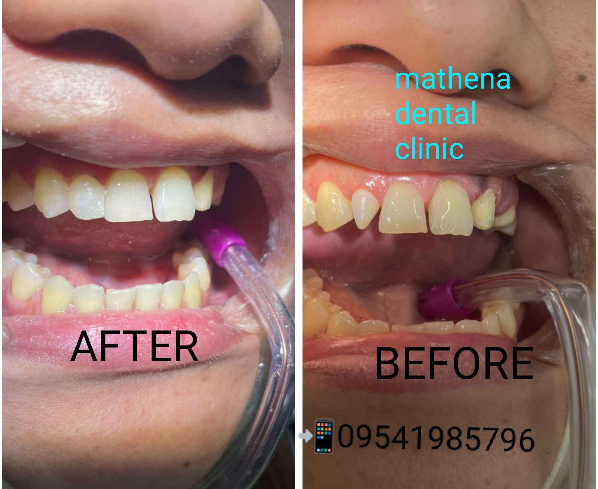 mathena dental clinic and direct laboratory