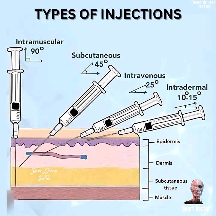 Babu - 💉 Types of injections explained! Understanding the angles ...