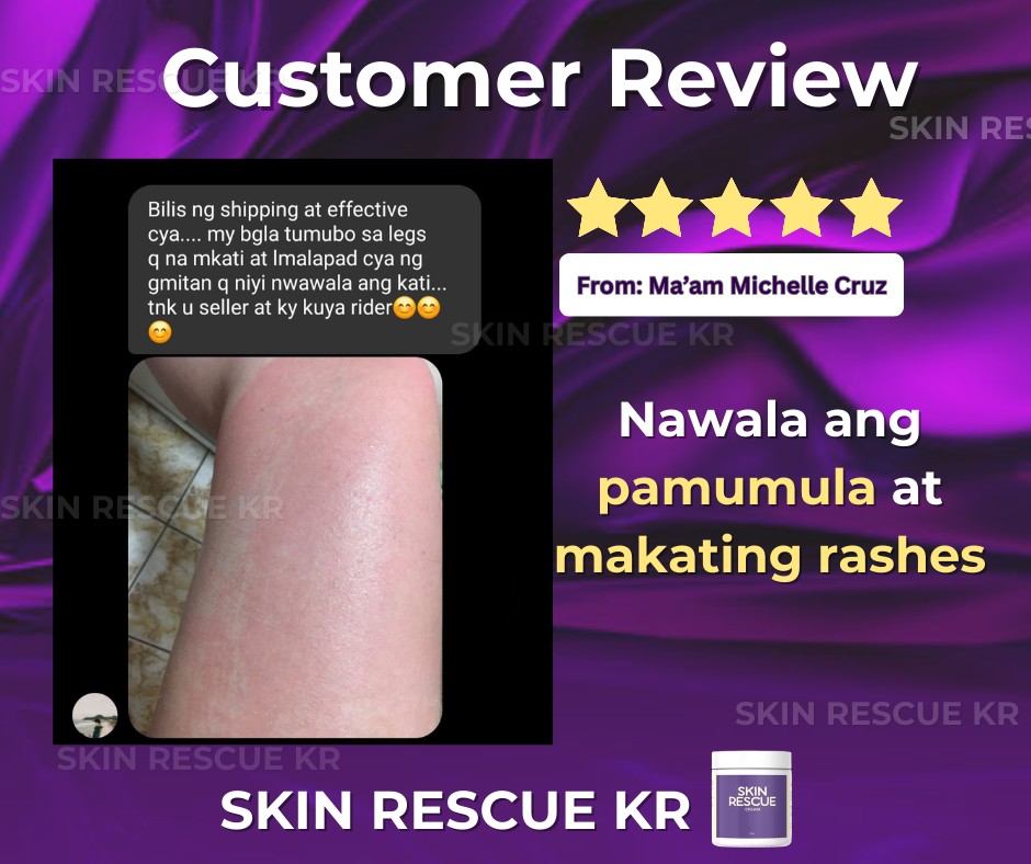 Dr. - “After using Skin Rescue Cream, nawala ang pamumula at makating ...