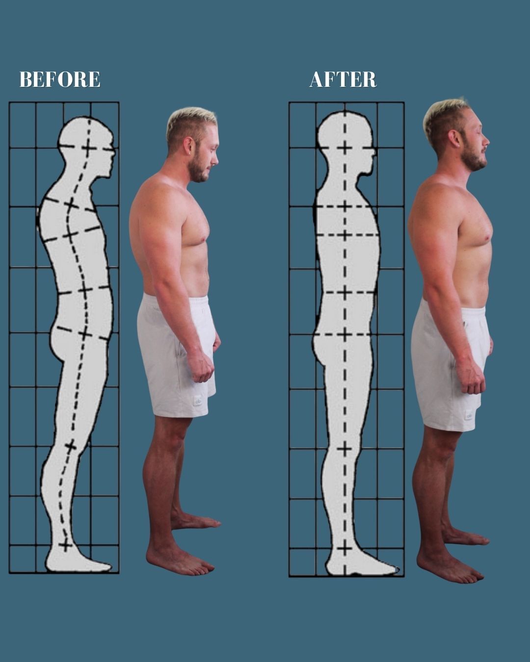 Structural - What Is Rolfing® (Structural Integration)? Rolfing is a ...
