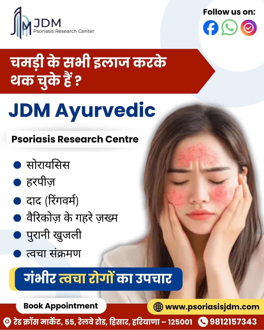 Psoriasis JDM | Hisar