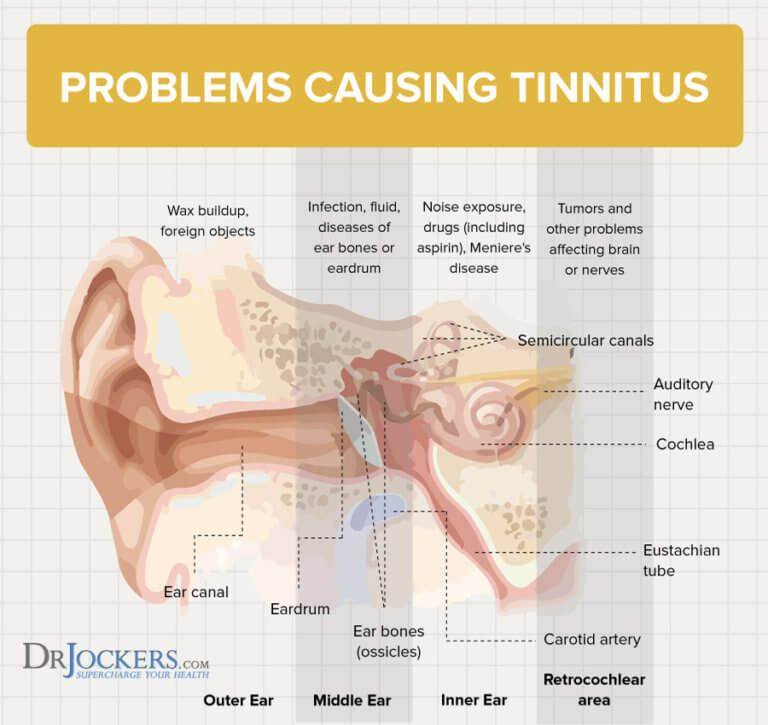 can semaglutide cause tinnitus case report Lenire Tinnitus Treatment: The First FDA-Approved Device for Tinnitus  What the Research Actually Shows Can Semaglutide Cause Headaches? Frequency