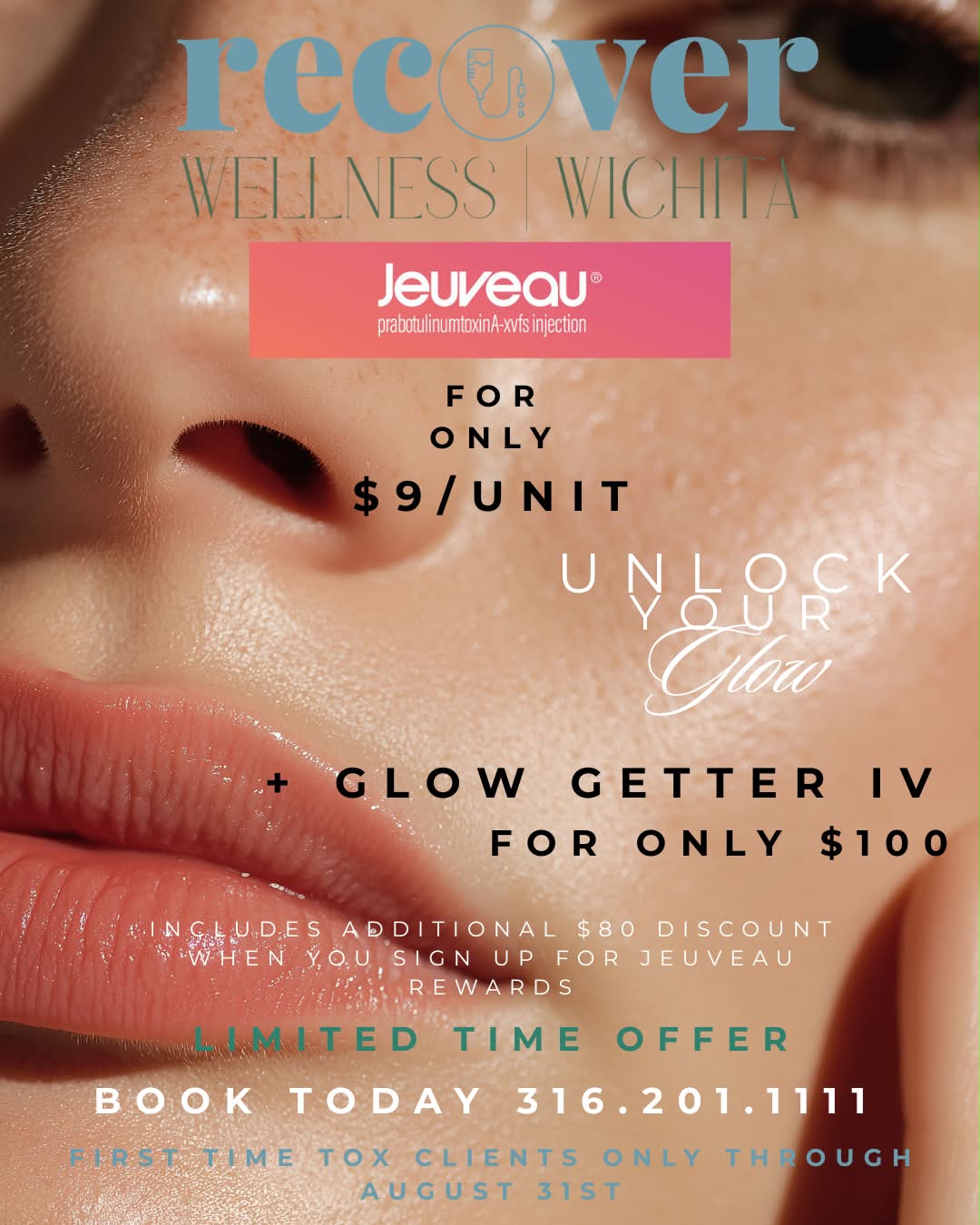 Limited time offer: Jeuveau for $9/unit and Glow Getter IV for $100 at Recover Wellness Wichita through August 31st