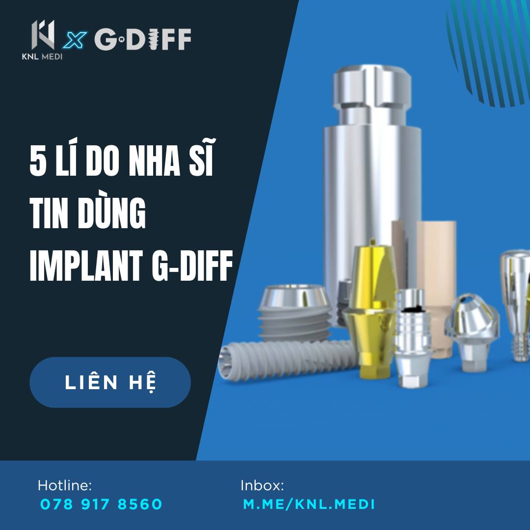 KNL - 5 LÍ DO NHA SĨ TIN DÙNG TRỤ IMPLANT G-DIFF! 1. Cố định kết nối ...