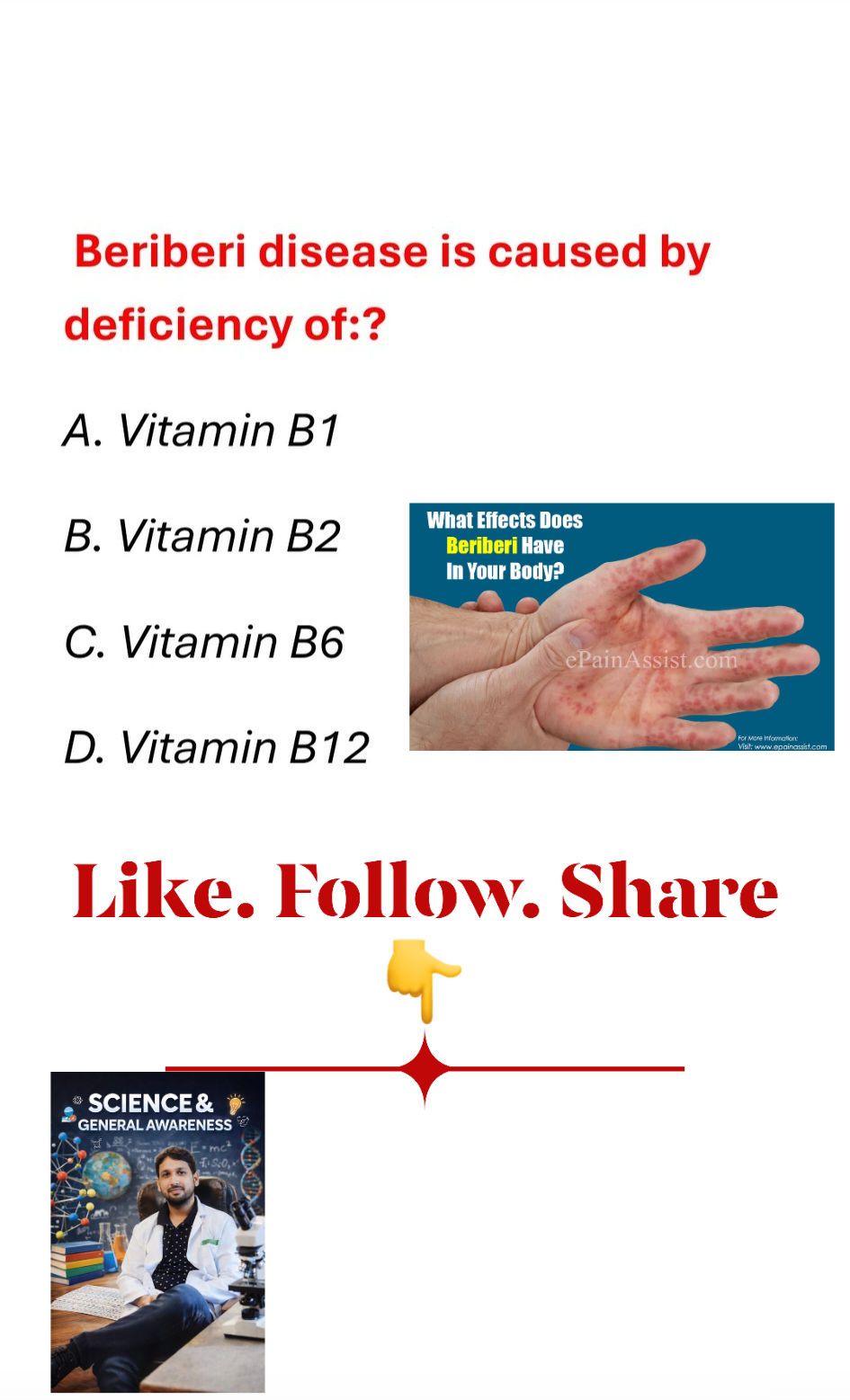 Beriberi disease is caused by deficiency of:? Comments your Answer 👇👇👇 #hilightseveryonefollowerseelsfypシ゚viralvideo #highlightseveryone #vitaminhtz #science #trendingreel #kimkardashian #healthcare #ad #lifestyle #education #minerals #minecraft 