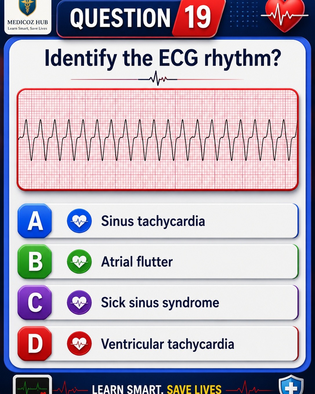 What is the rhythm interpretation of an ECG with no P waves and a