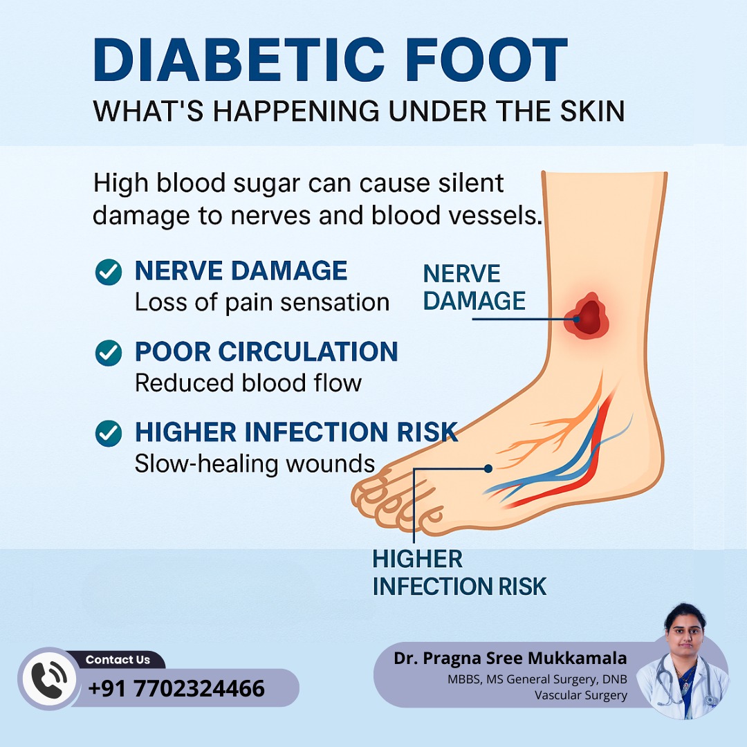 DrpragnasVascular - ⚠️ Diabetic Foot: The hidden damage you can’t see ...