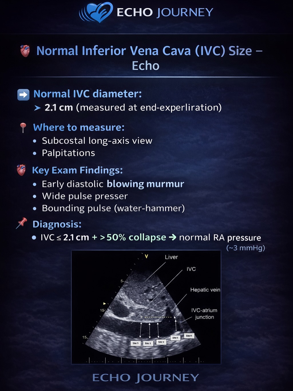 Echo Journey - 🫀 Inferior Vena Cava (IVC) 🔵 What is IVC?... | Facebook