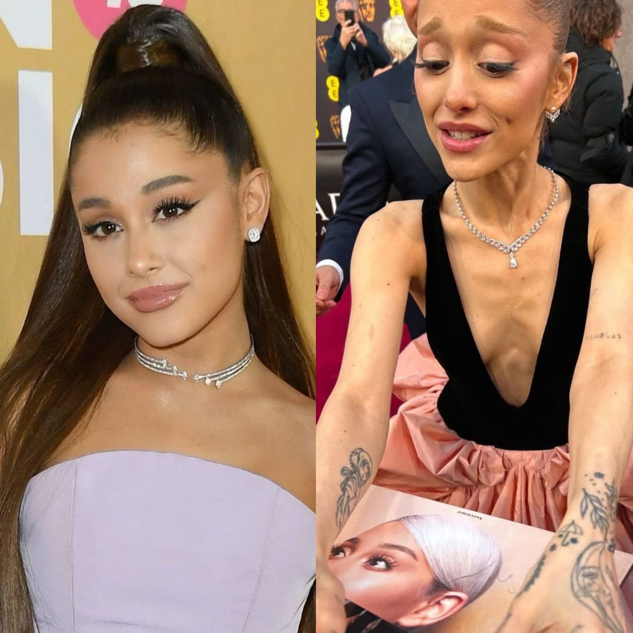 I get people change over the years but this is crazy. Ariana Grande lost so much weight. Hopefully, she returns to good health soon !