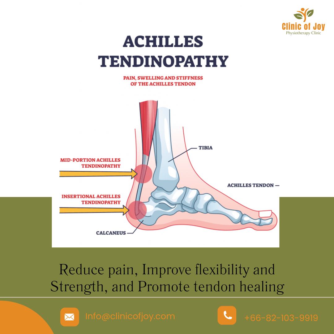 Clinic - Achilles tendinopathy is typically classified into two types ...