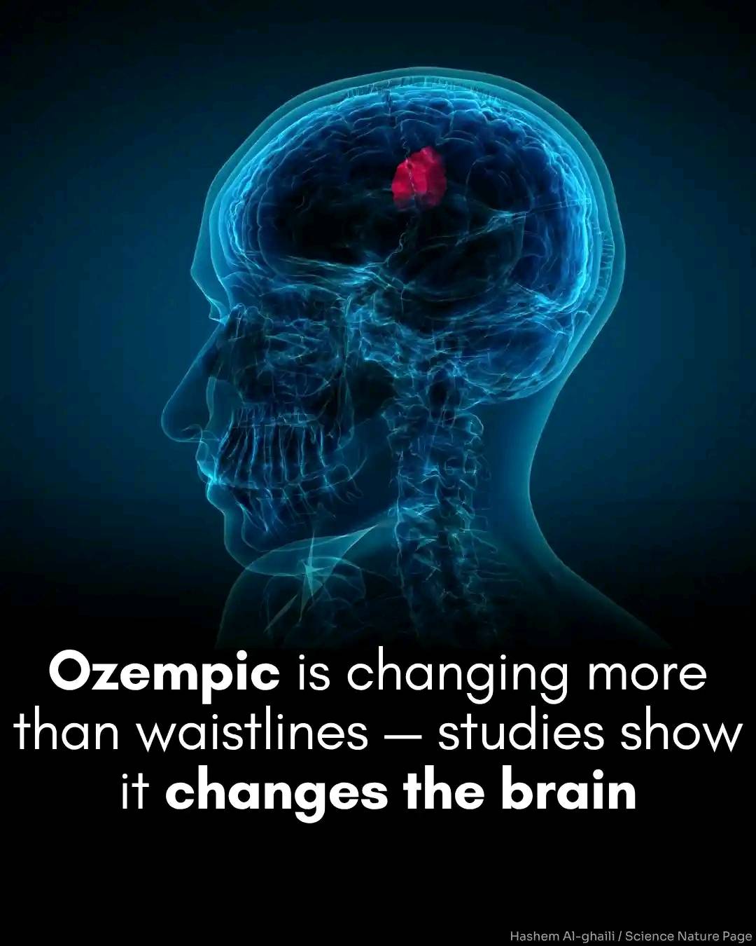 Does Ozempic cause dry mouth or bad taste?