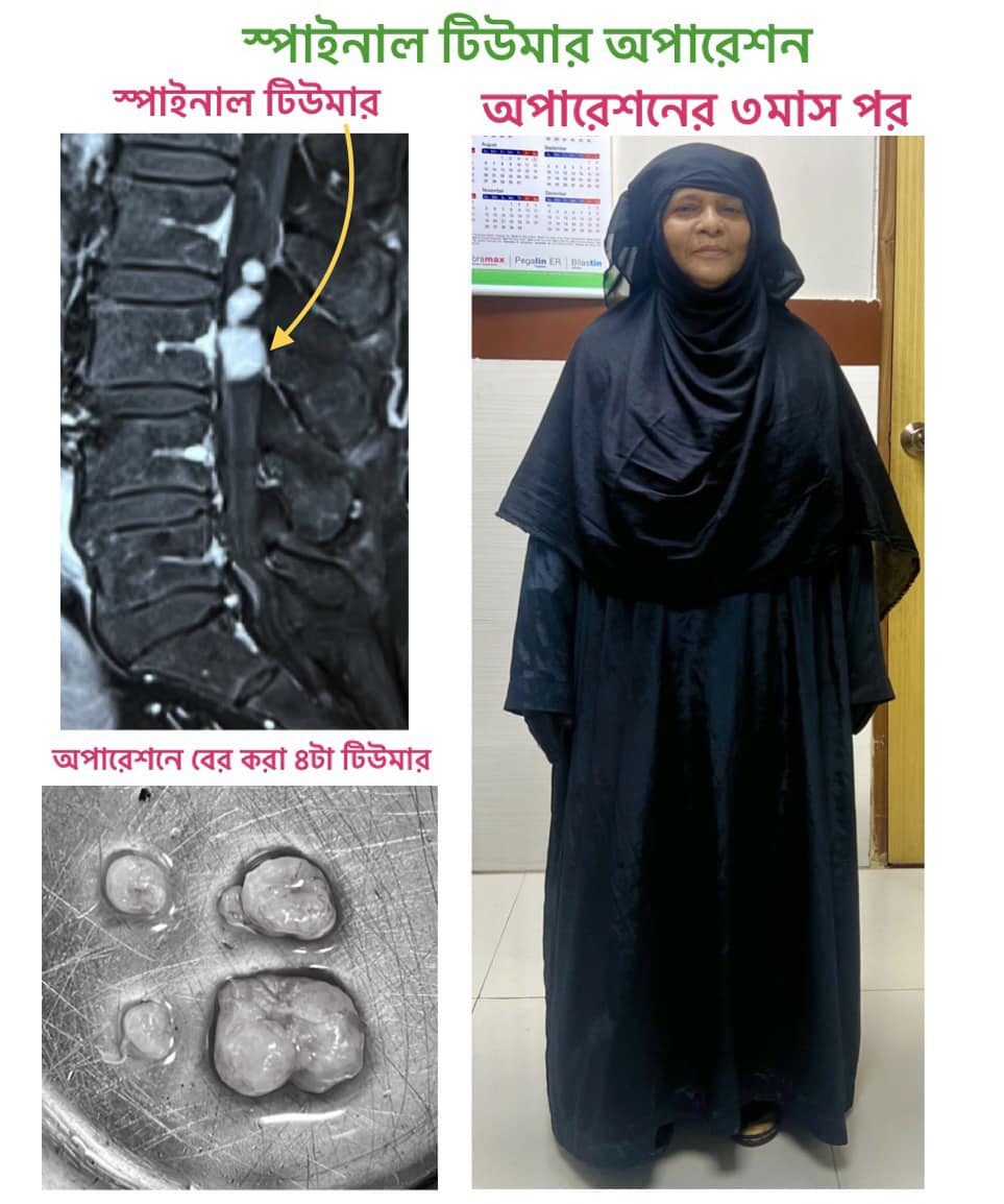Brain & Spine Surgeon Dr Rokibul Islam Rokib | Dhaka