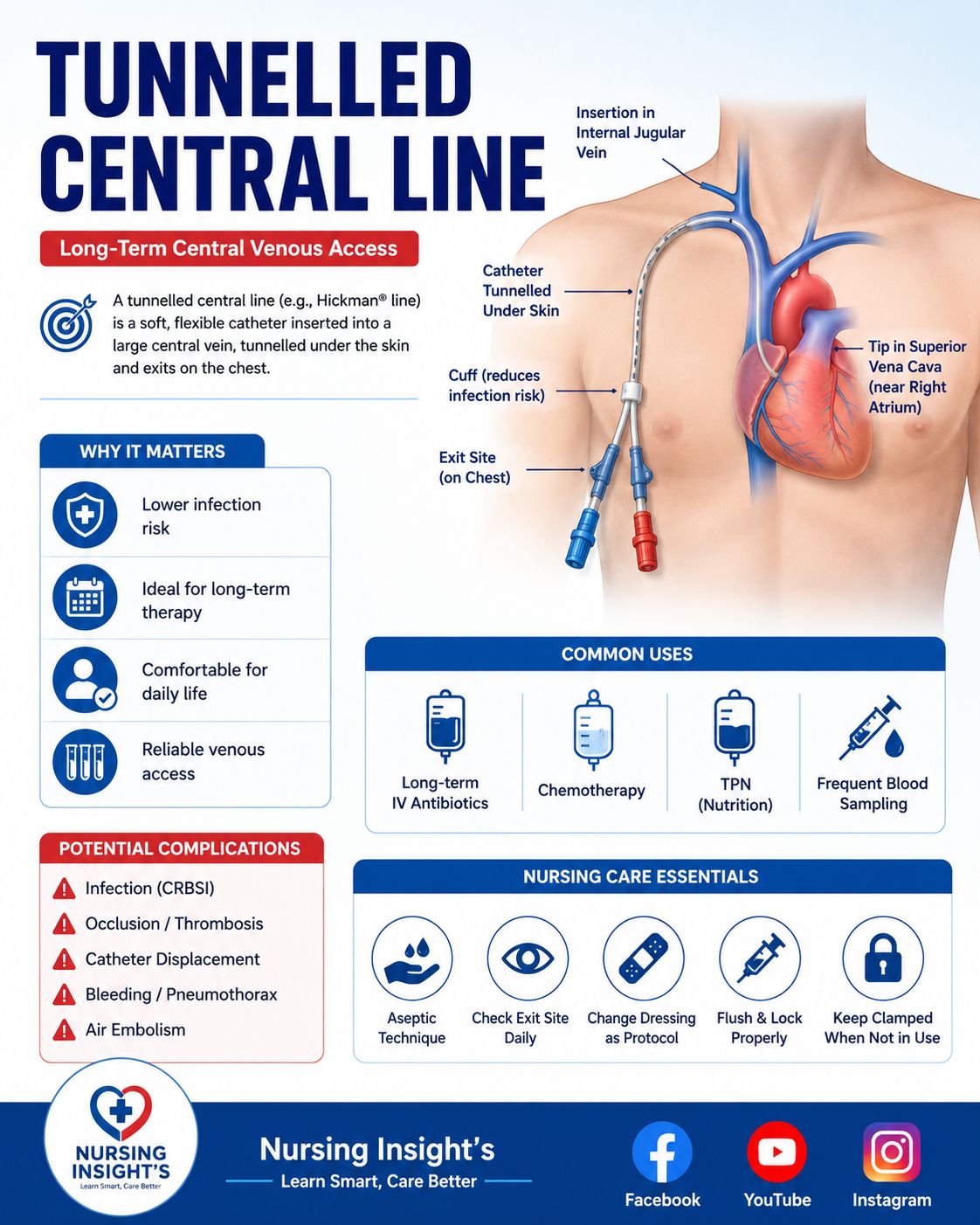 central line dressing change protocol Medline Trays, Includes Gauze, Gloves, Alcohol & PVP Swabsticks, Sterile, Case of 24 Each : Industrial & Scientific PICC Dressing Kit PICC &