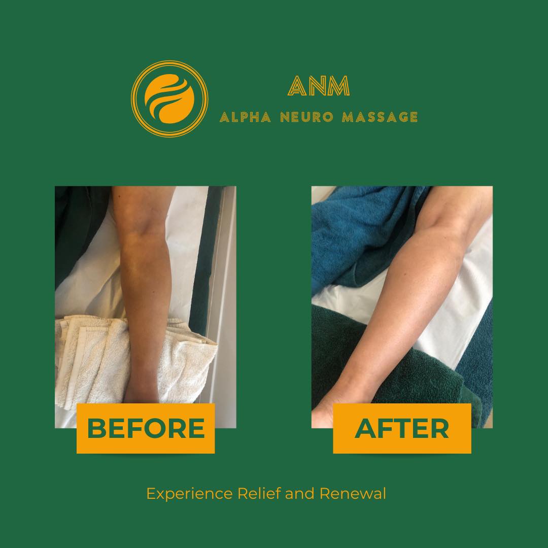 Alpha Neuro Massage