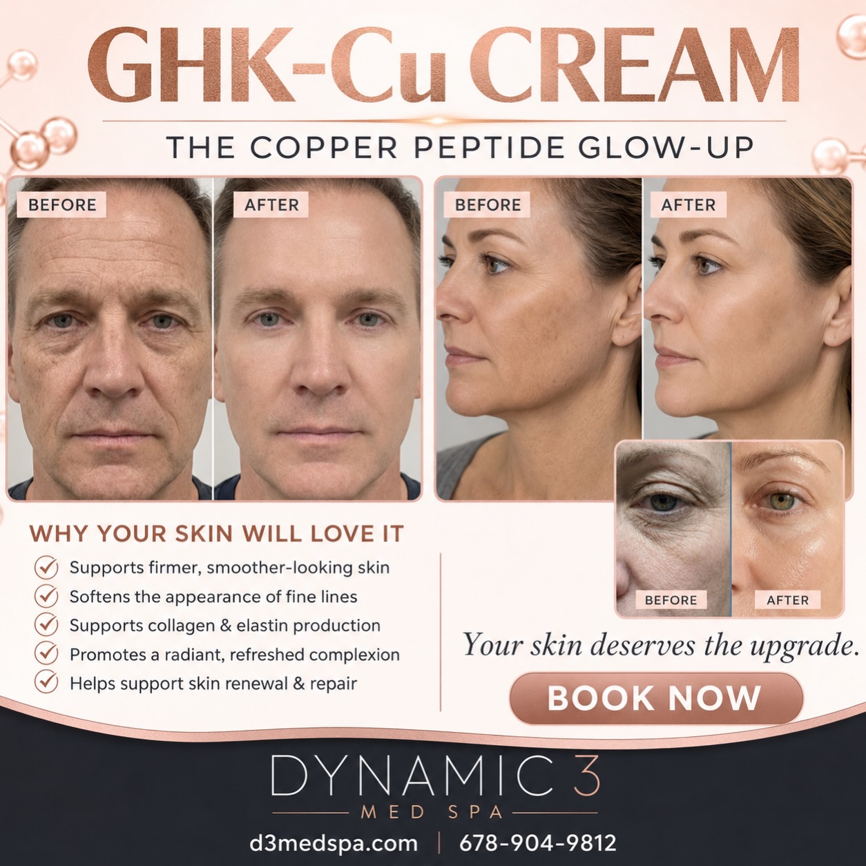 ghk cu transformation Your skincare starts NOW! ✨ GHK-Cu Cream is the copper peptide glow-up your skin has been waiting for supporting smoother, firmer-looking skin while helping improve the appearance of fine lines and tighten skin Peptide Dosing Schedule Bpc-157 Size:1-gallon