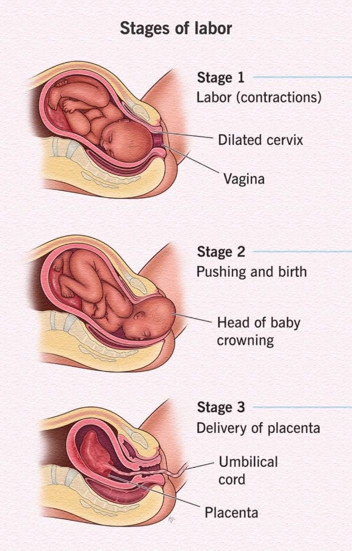 Natural - The Three Stages of Labor The childbirth process is divided ...