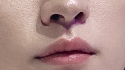 Lip focus by mimilee @minolinori #리노 #LeeKnow #リノ #李旻浩