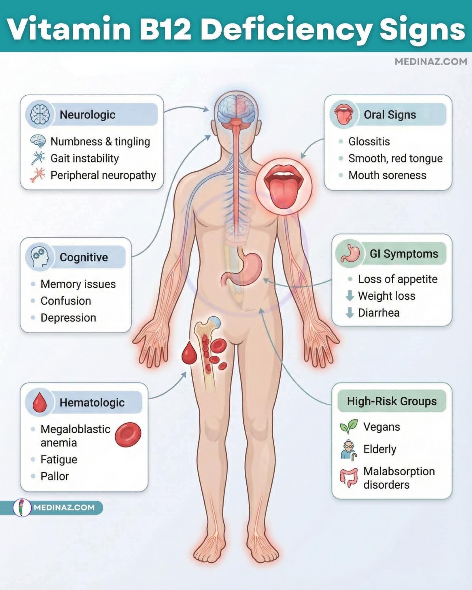 Vitamin B12 Deficiency 🔹 Causes megaloblastic (macrocytic) anemia 🔹 Needed for DNA synthesis and neurologic function 🔹 Pernicious anemia = classic cause (lack of intrinsic factor) Causes 🔹 Pernicious anemia 🔹 Vegan