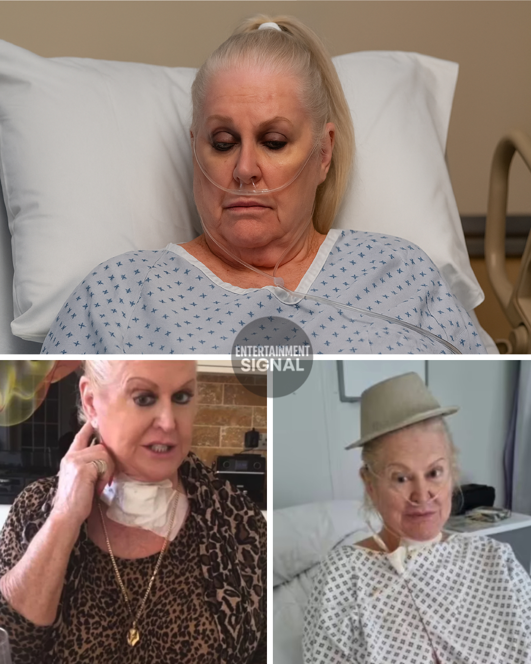 kim woodburn plastic surgery Image 6