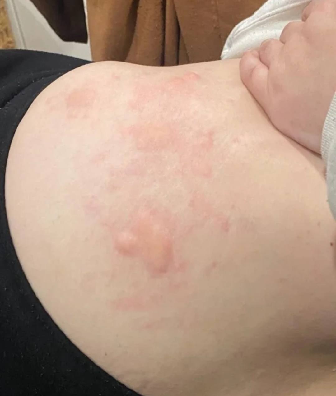 Hello, everyone! I am in my early 30s and have been having multiple tissue and organ symptoms for more than a year. My rheumatologist called them bizzare symptoms. One of the general